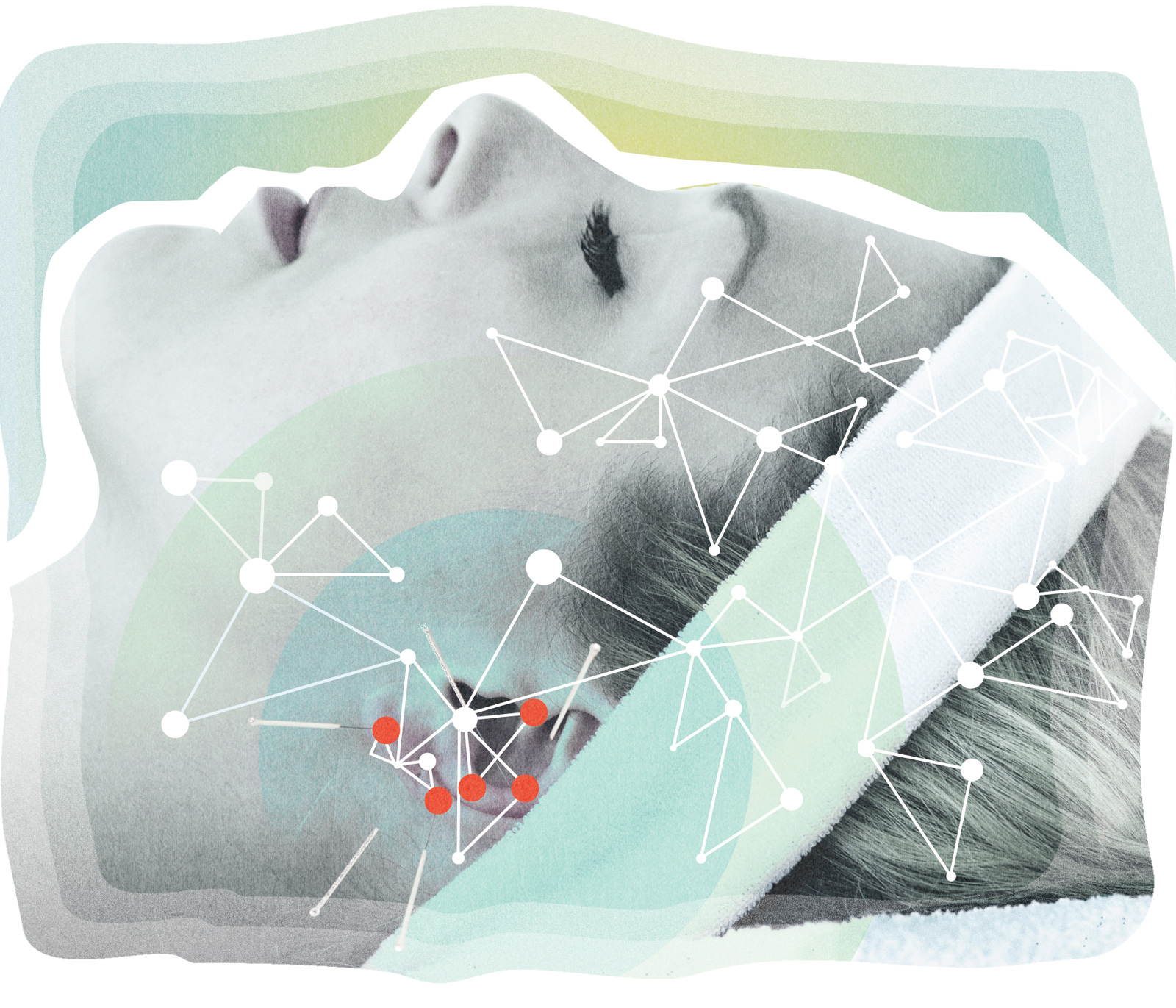 acupuncture-illustration