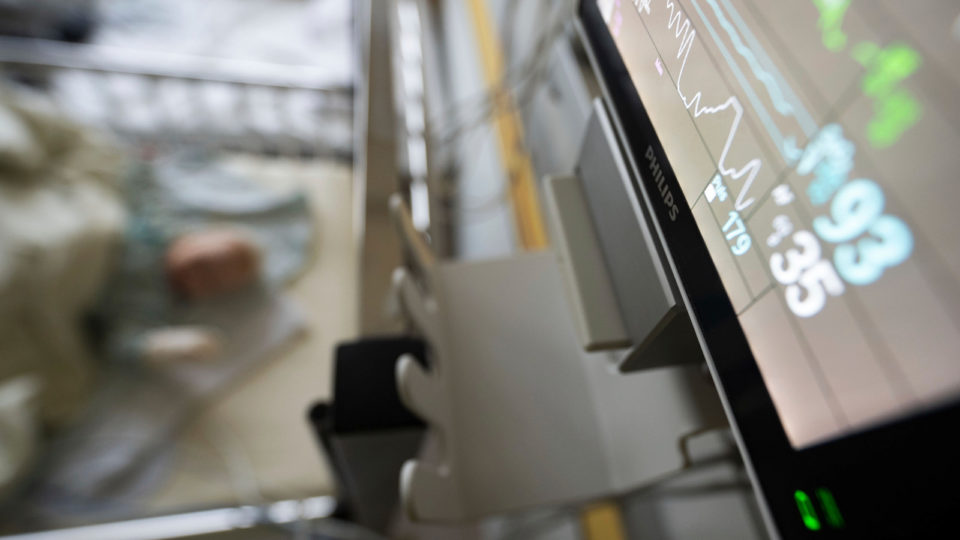 A screen in a hospital room shows many colorful lines.